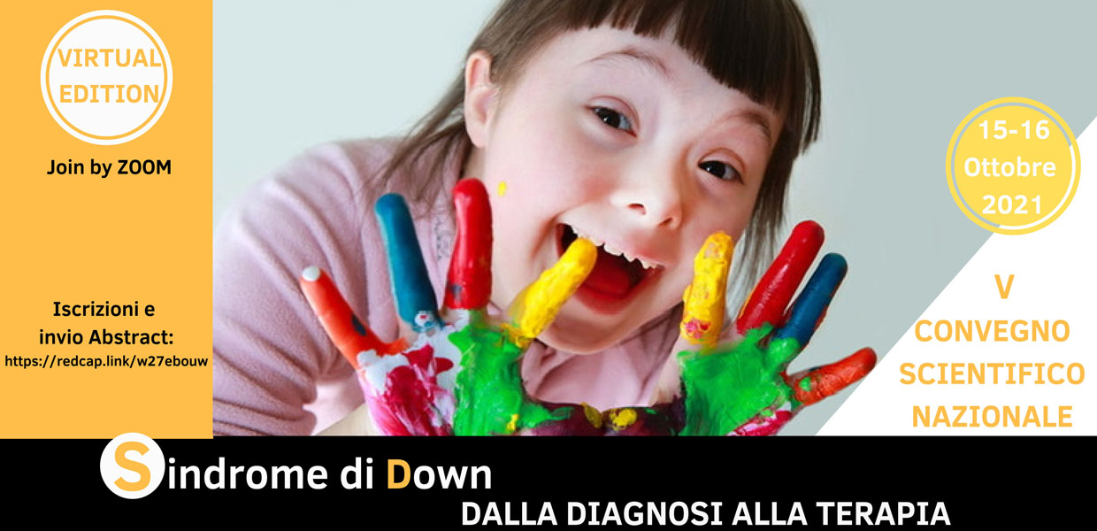 Sindrome di Down
